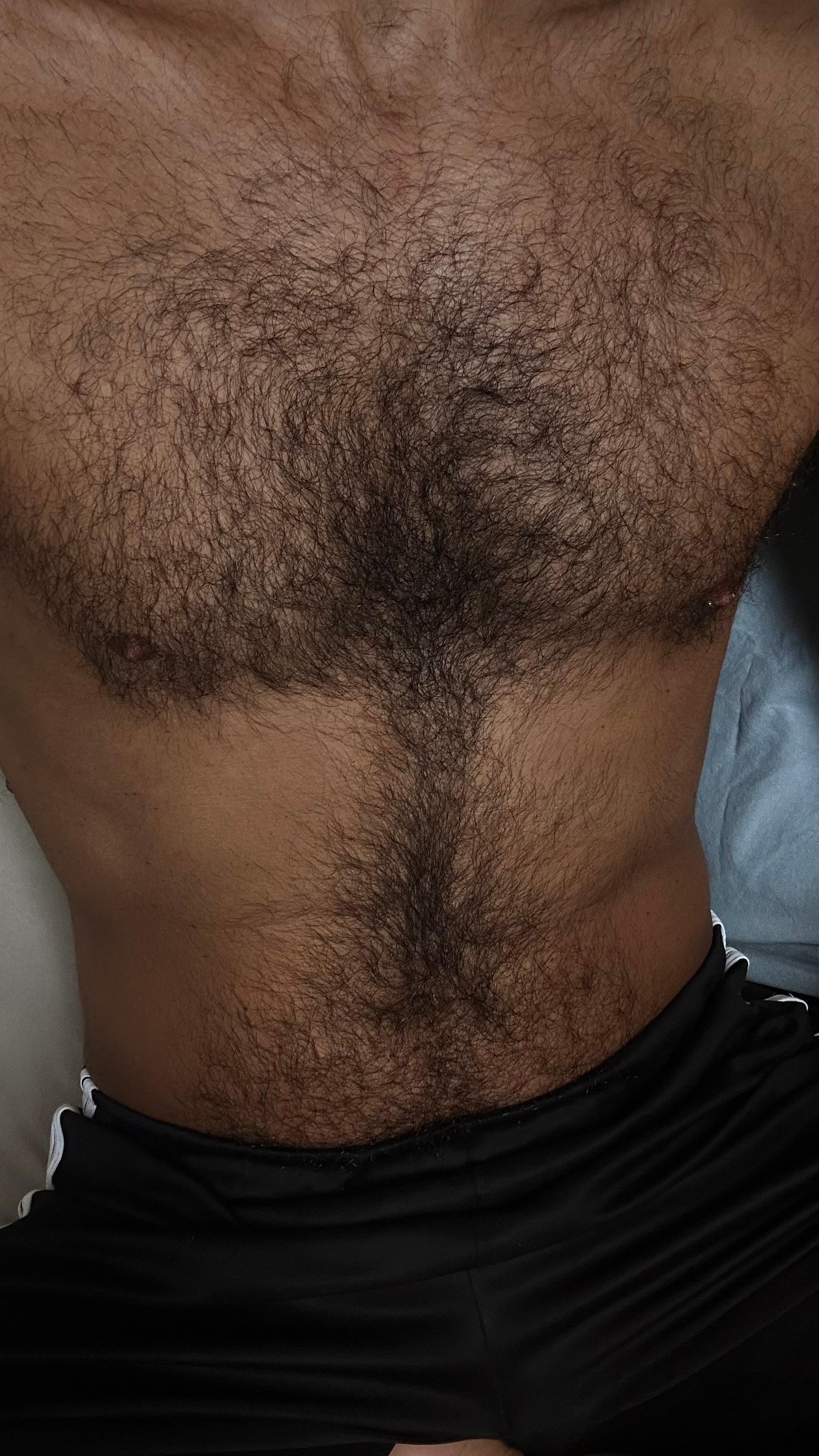 Peludao25